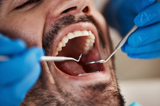 Best Emergency Root Canal Therapy in De Soto, KS